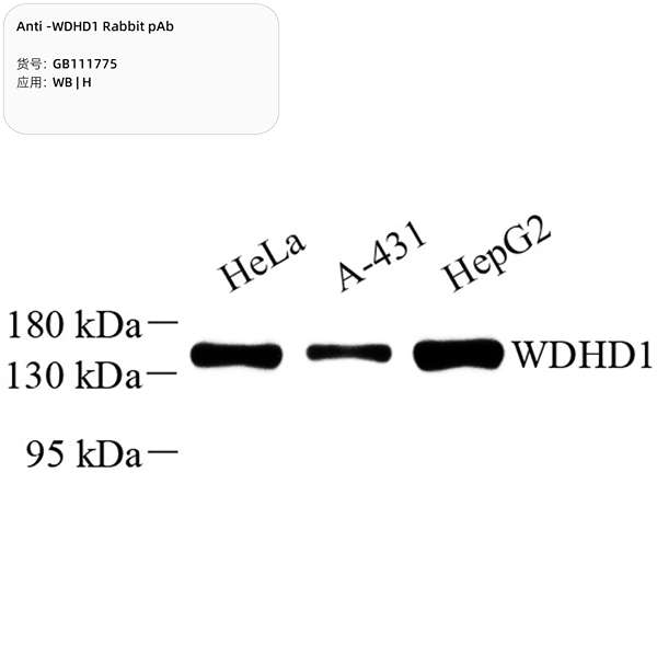 Антитела первичные, поликлональные, WDHD1, 100 мкл