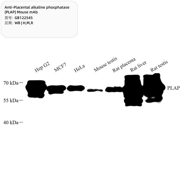Антитела первичные, моноклональные, Placental alkaline phosphatase (PLAP), 100 мкл