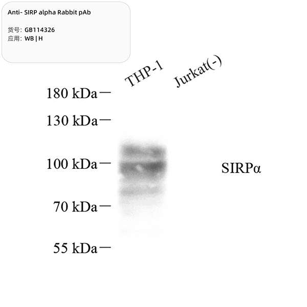 Антитела первичные, поликлональные, SIRP alpha, 100 мкл