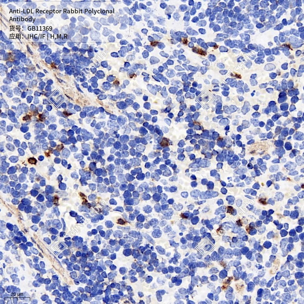 Антитела первичные, поликлональные кролика к LDL Receptor крысы, мыши, человека, 100 мкл