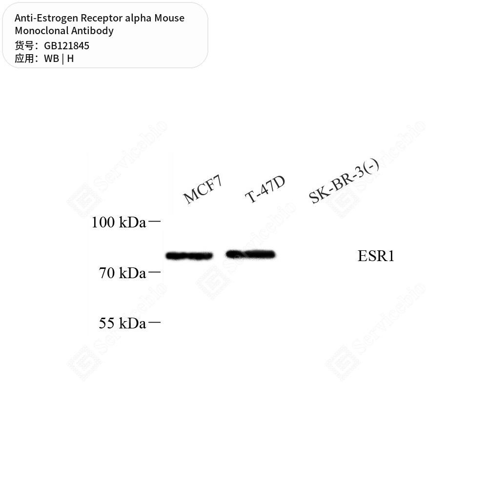 Антитела первичные, моноклональные мыши к Estrogen Receptor alpha человека, 50 мкл