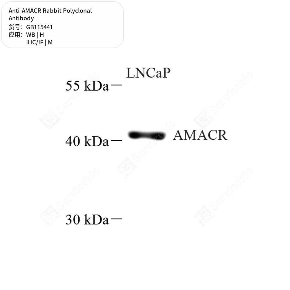 Антитела первичные, поликлональные кролика к AMACR мыши, человека, 50 мкл
