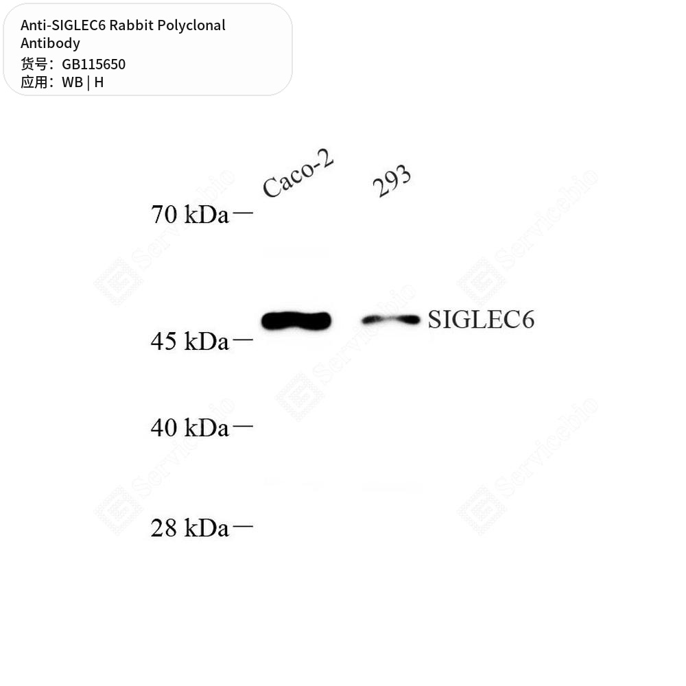Антитела первичные, поликлональные кролика к SIGLEC6 человека, 50 мкл