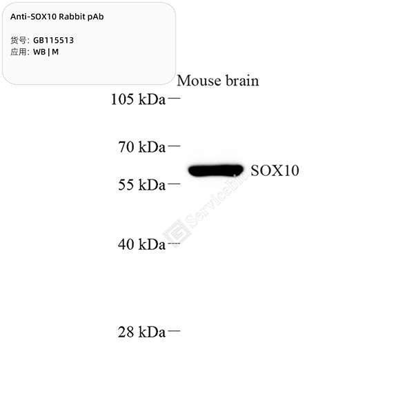 Антитела первичные, поликлональные, SOX10, 100 мкл