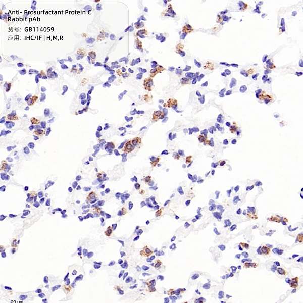 Антитела первичные, поликлональные, Prosurfactant Protein C, 100 мкл
