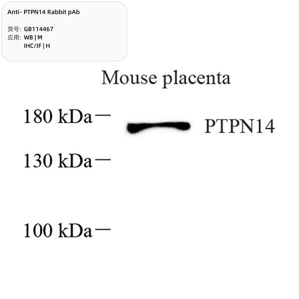 Антитела первичные, поликлональные, PTPN14, 100 мкл