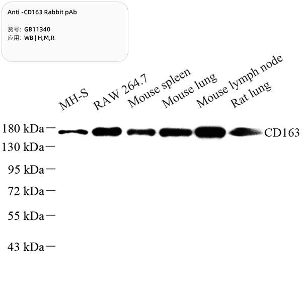 Антитела первичные, поликлональные, CD163, 100 мкл