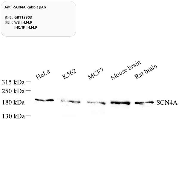 Антитела первичные, поликлональные, SCN4A, 100 мкл