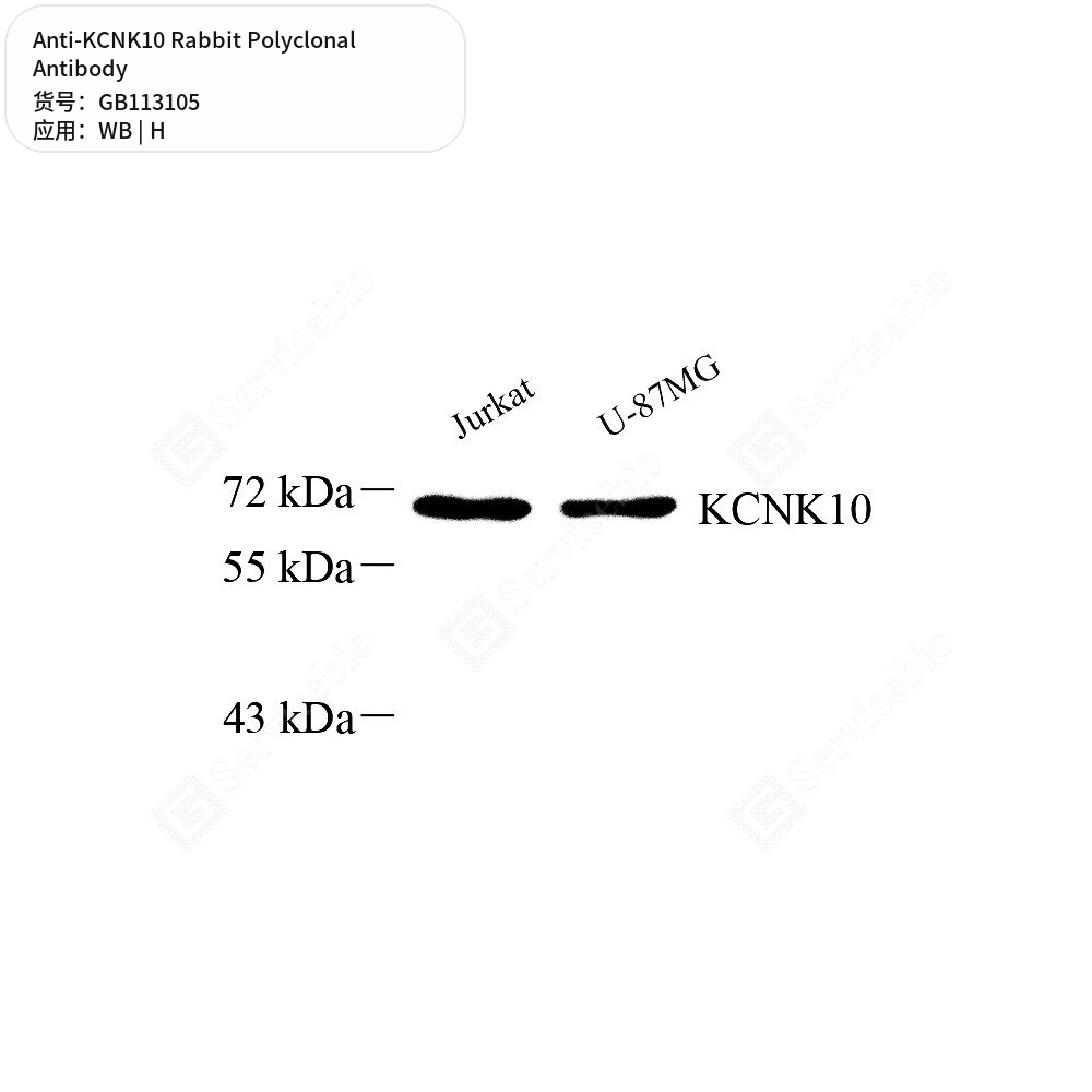Антитела первичные, поликлональные кролика к KCNK10 человека, 100 мкл