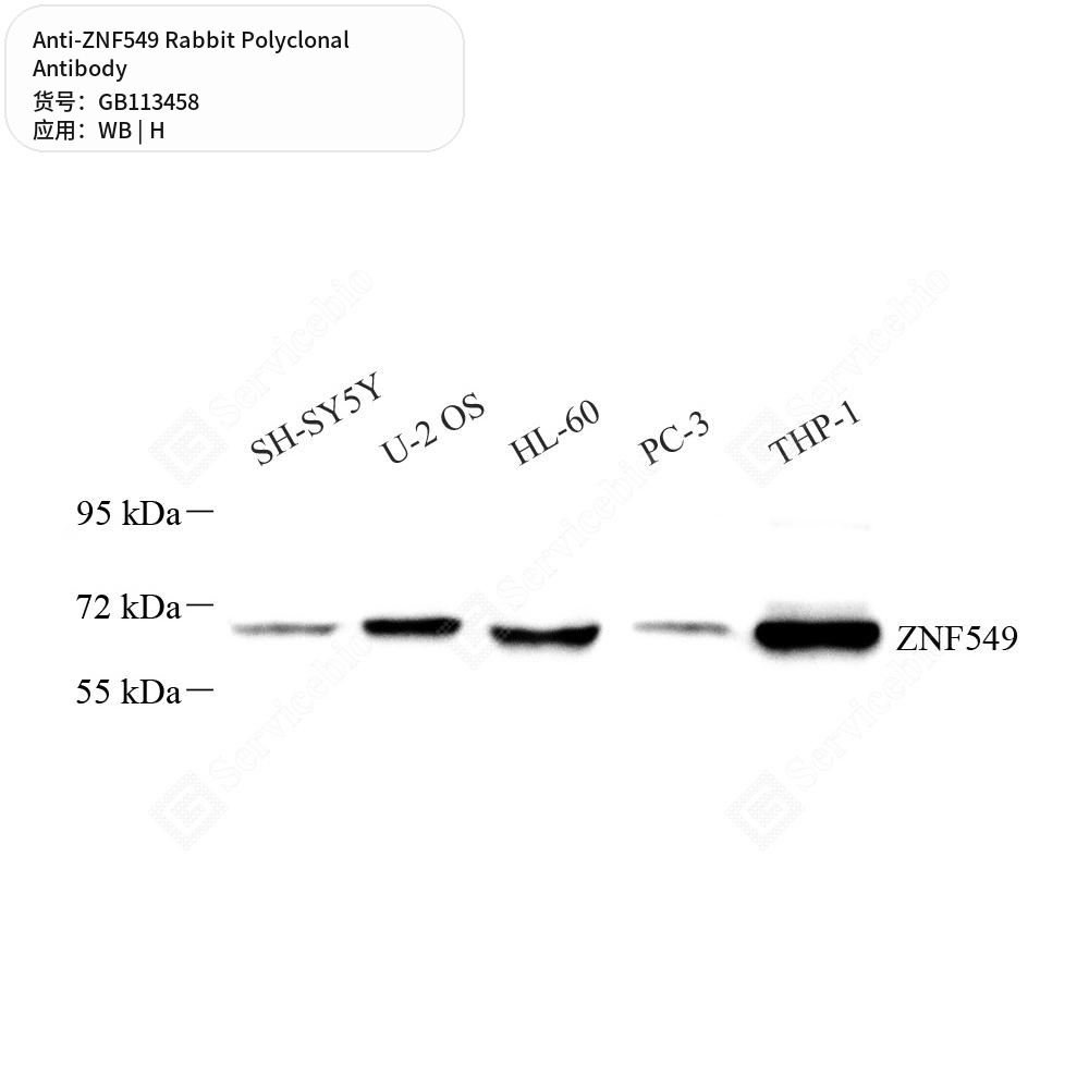 Антитела первичные, поликлональные кролика к ZNF549 человека, 50 мкл