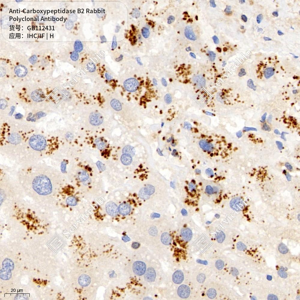 Антитела первичные, поликлональные кролика к Carboxypeptidase B2 человека, 100 мкл