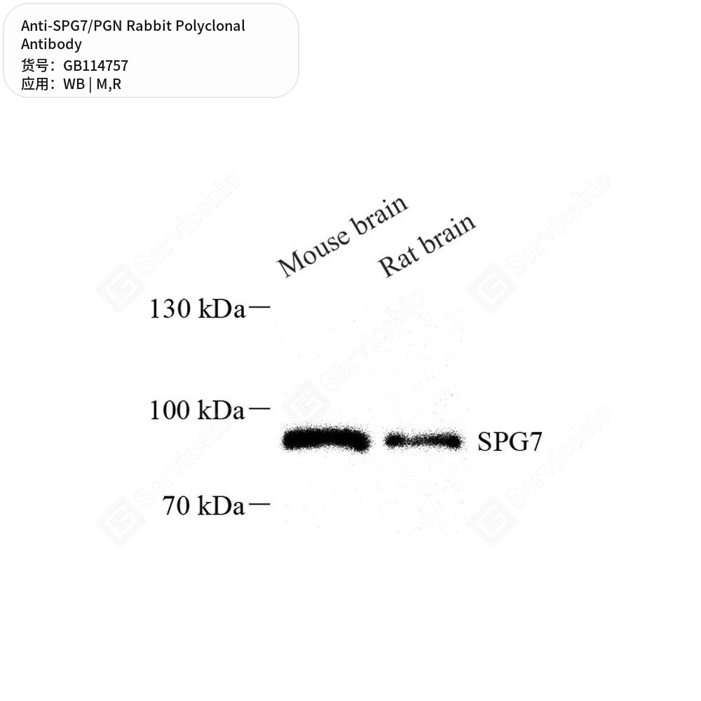 Антитела первичные, поликлональные кролика к SPG7/PGN крысы, мыши, 100 мкл