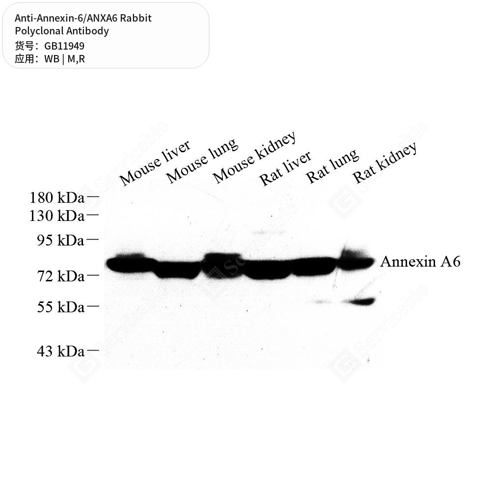 Антитела первичные, поликлональные кролика к Annexin-6/ANXA6 крысы, мыши, 100 мкл