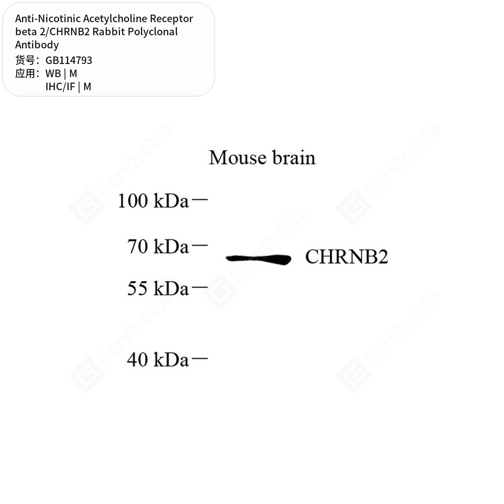 Антитела первичные, поликл. кролика к Nicotinic Acetylcholine Receptor beta 2/CHRNB2 мыши, 50 мкл