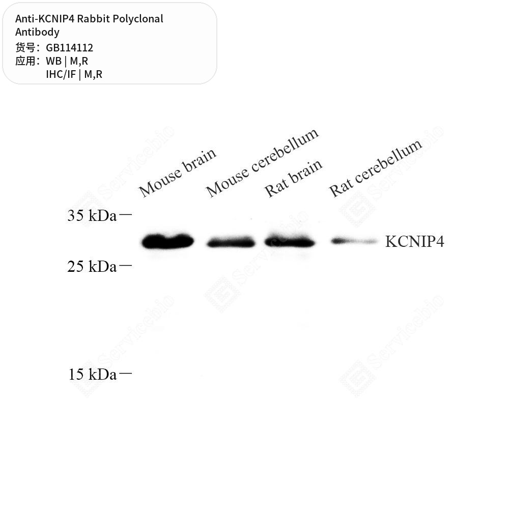 Антитела первичные, поликлональные кролика к KCNIP4 крысы, мыши, 100 мкл