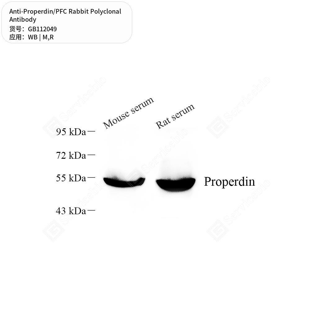 Антитела первичные, поликлональные кролика к Properdin/PFC крысы, мыши, 100 мкл