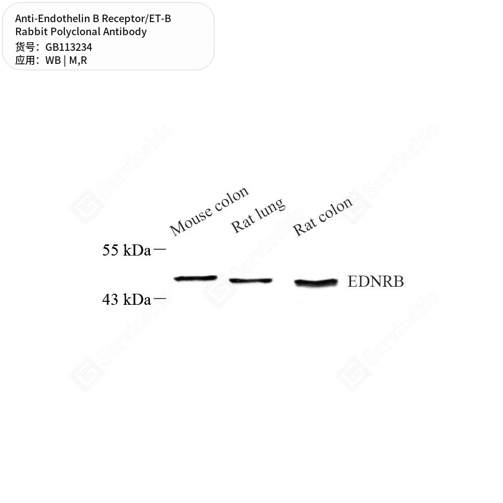 Антитела первичные, поликлональные кролика к Endothelin B Receptor/ET-B крысы, мыши, 100 мкл