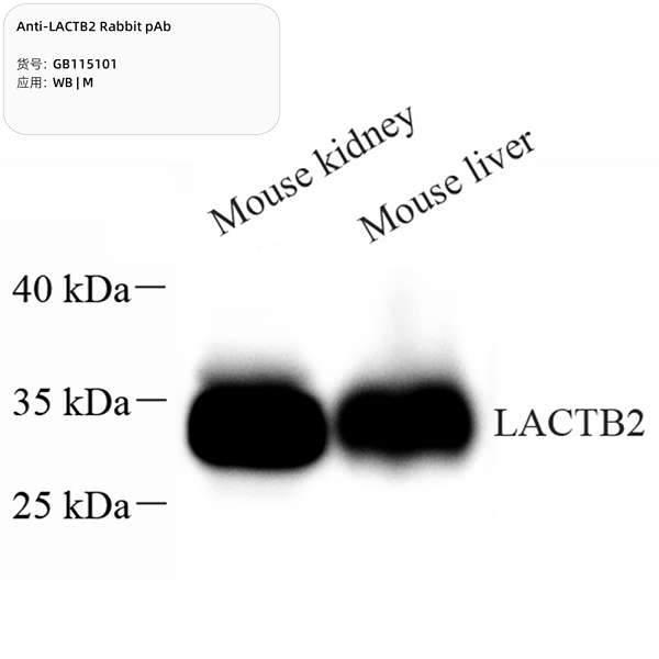 Антитела первичные, поликлональные, LACTB2, 100 мкл