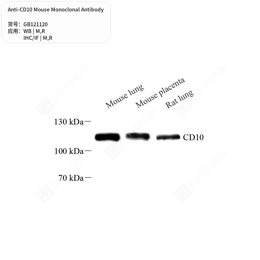 Антитела первичные, моноклональные мыши к CD10 крысы, мыши, 50 мкл
