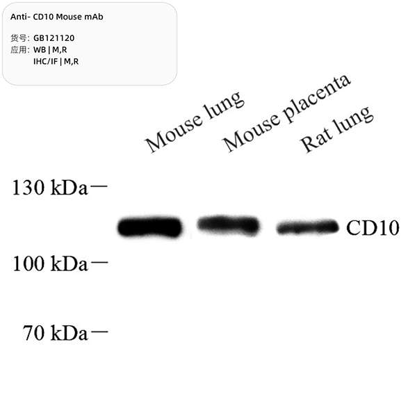 Антитела первичные, моноклональные, CD10, 100 мкл