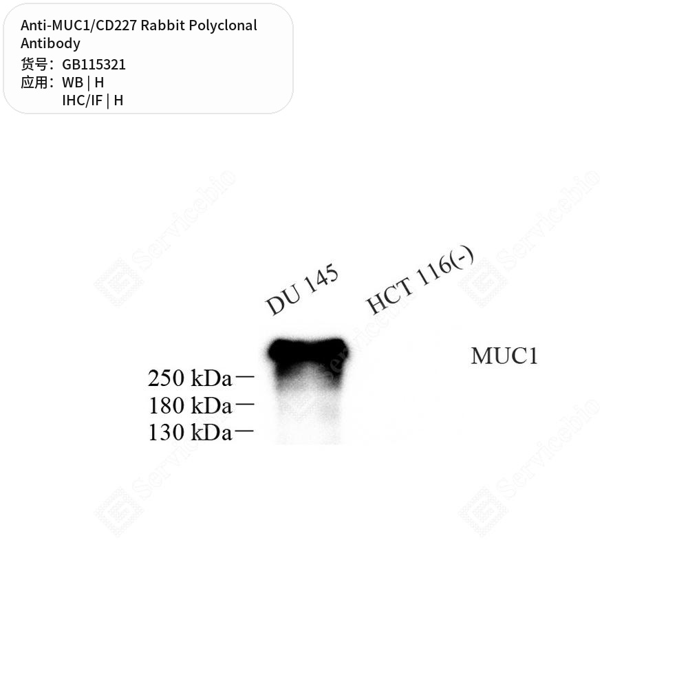 Антитела первичные, поликлональные кролика к MUC1/CD227 человека, 100 мкл