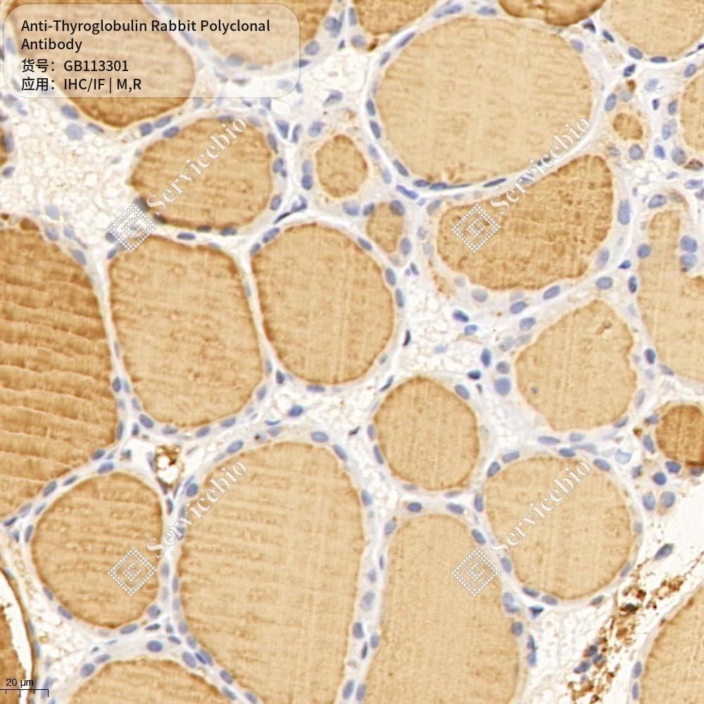 Антитела первичные, поликлональные кролика к Thyroglobulin крысы, мыши, 100 мкл