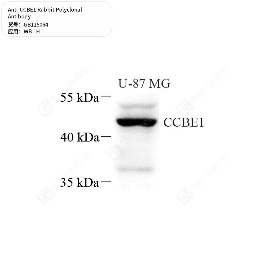 Антитела первичные, поликлональные кролика к CCBE1 человека, 50 мкл
