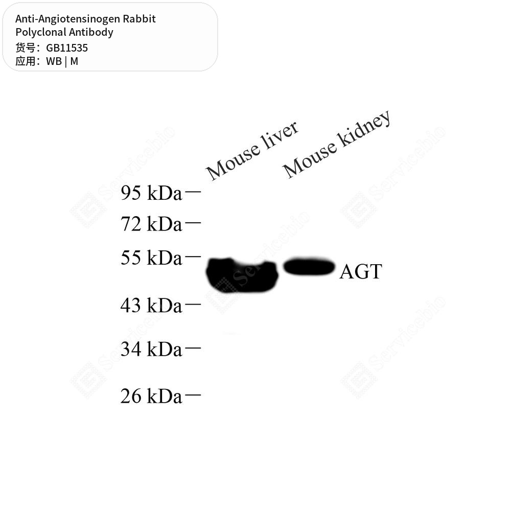 Антитела первичные, поликлональные кролика к Angiotensinogen мыши, 50 мкл