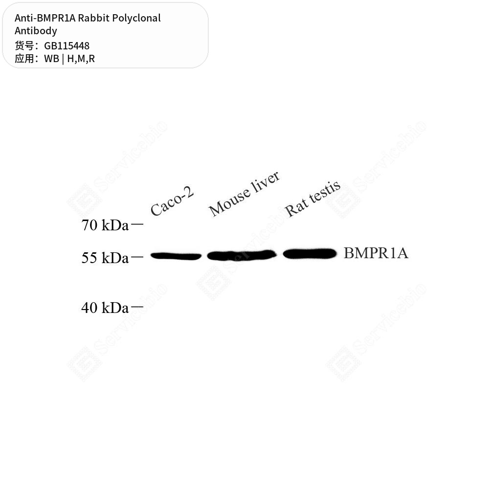 Антитела первичные, поликлональные кролика к BMPR1A крысы, мыши, человека, 50 мкл