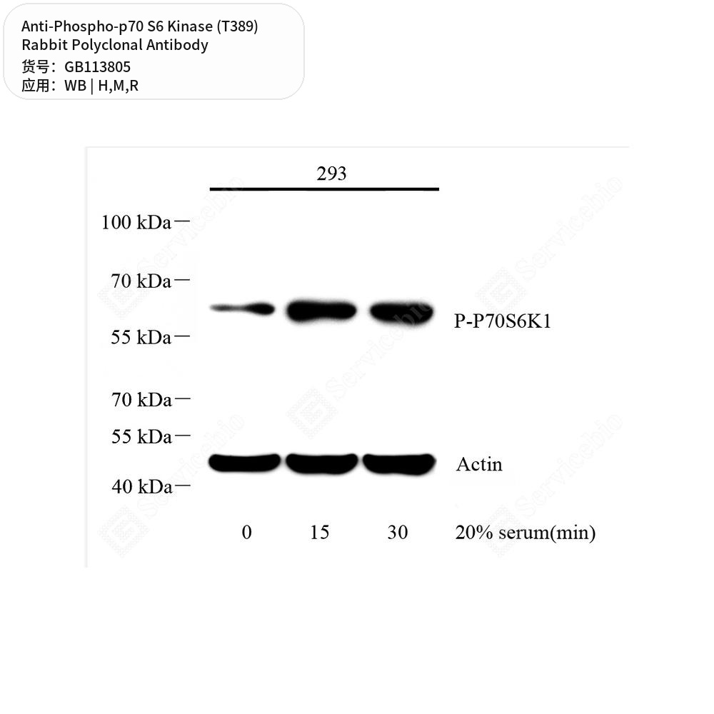 Антитела первичные, поликл. кролика к Phospho-p70 S6 Kinase (T389) крысы, мыши, человека, 100 мкл