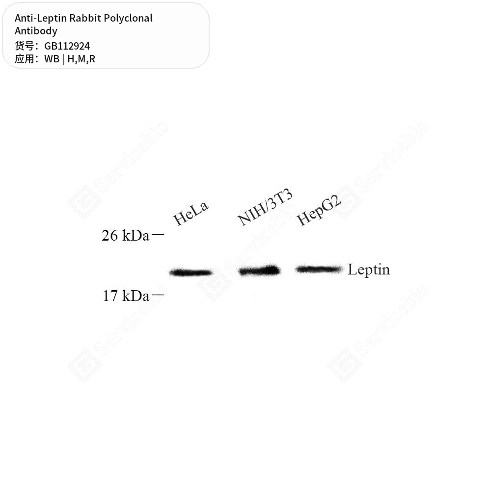 Антитела первичные, поликлональные кролика к Leptin крысы, мыши, человека, 50 мкл