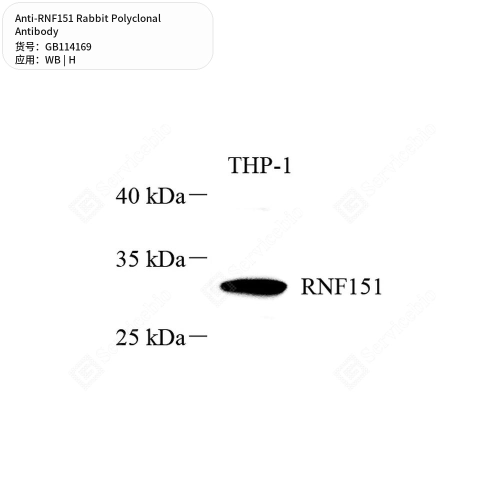 Антитела первичные, поликлональные кролика к RNF151 человека, 50 мкл