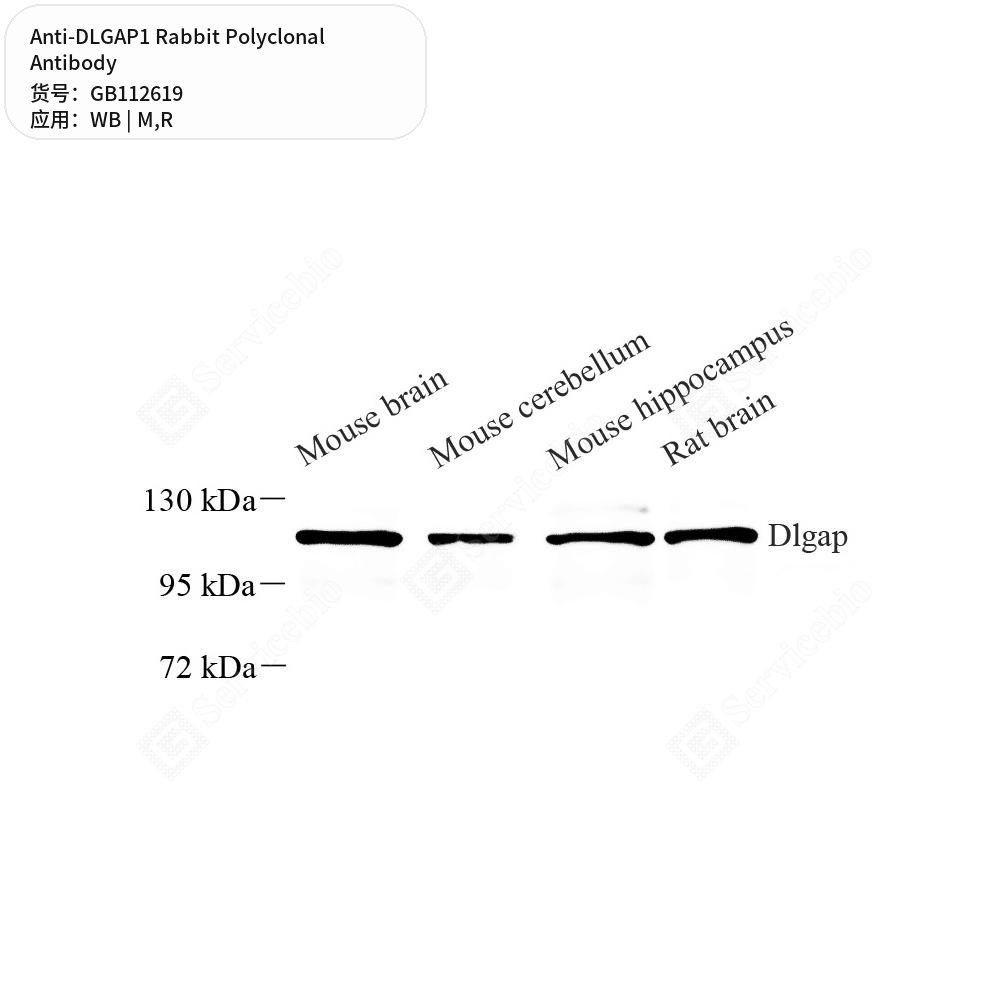 Антитела первичные, поликлональные кролика к DLGAP1 крысы, мыши, 100 мкл