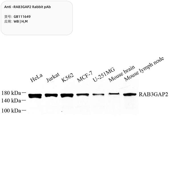 Антитела первичные, поликлональные, RAB3GAP2, 100 мкл