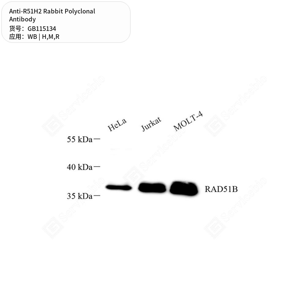 Антитела первичные, поликлональные кролика к R51H2 крысы, мыши, человека, 100 мкл