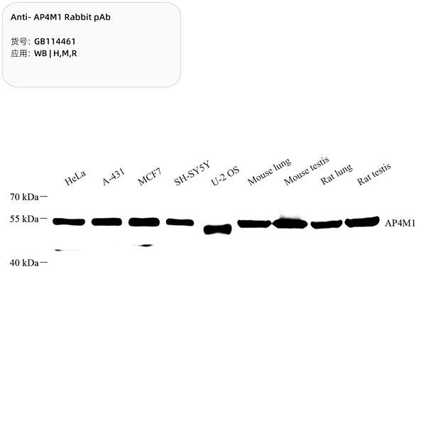 Антитела первичные, поликлональные, AP4M1, 100 мкл