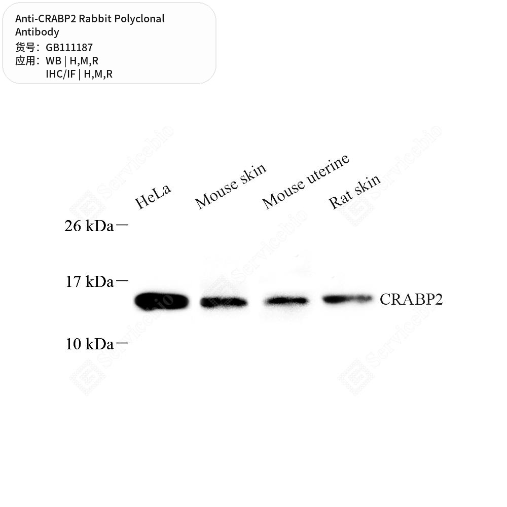Антитела первичные, поликлональные кролика к CRABP2 крысы, мыши, человека, 100 мкл