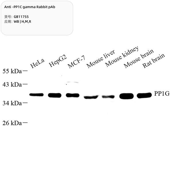 Антитела первичные, поликлональные, PP1C gamma, 100 мкл