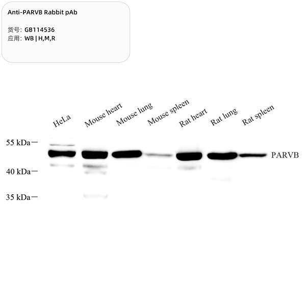 Антитела первичные, поликлональные, PARVB, 100 мкл