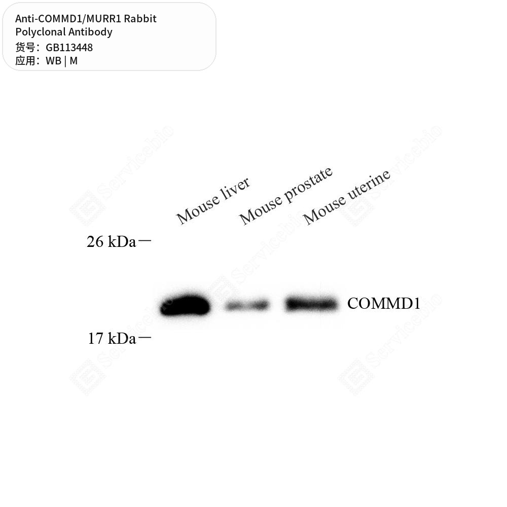 Антитела первичные, поликлональные кролика к COMMD1/MURR1 мыши, 100 мкл