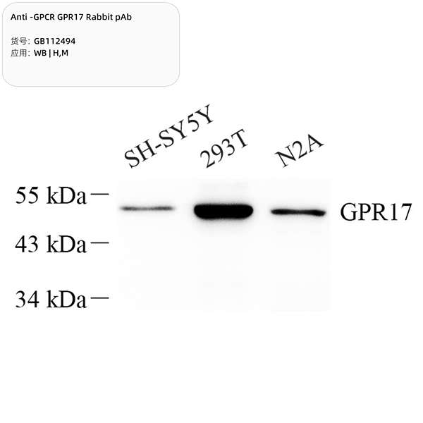 Антитела первичные, поликлональные, GPCR GPR17, 100 мкл