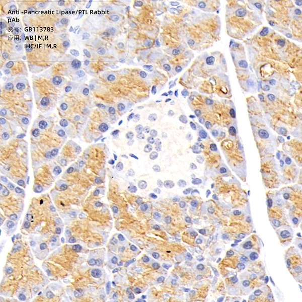 Антитела первичные, поликлональные, Pancreatic Lipase/PTL, 100 мкл
