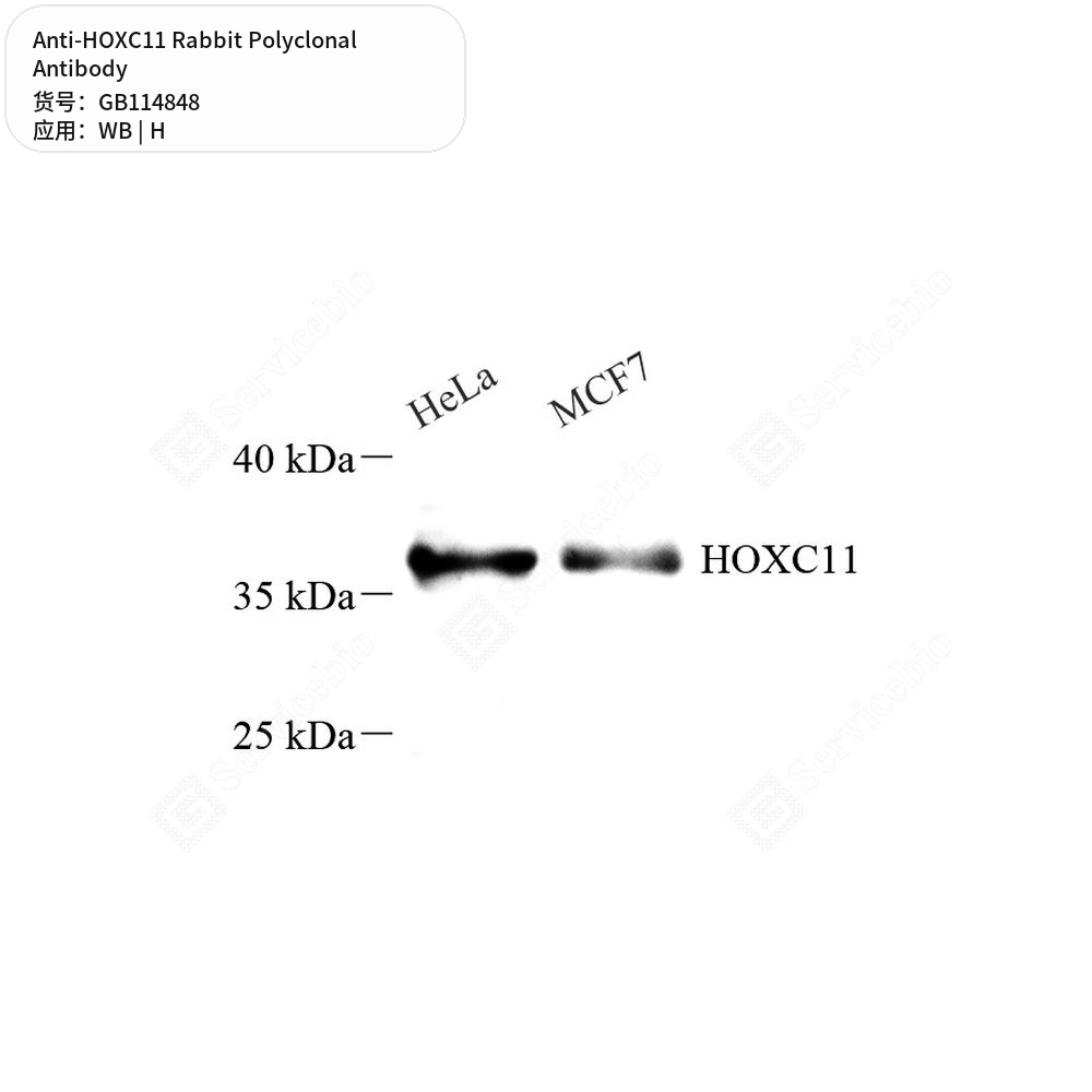 Антитела первичные, поликлональные кролика к HOXC11 человека, 100 мкл