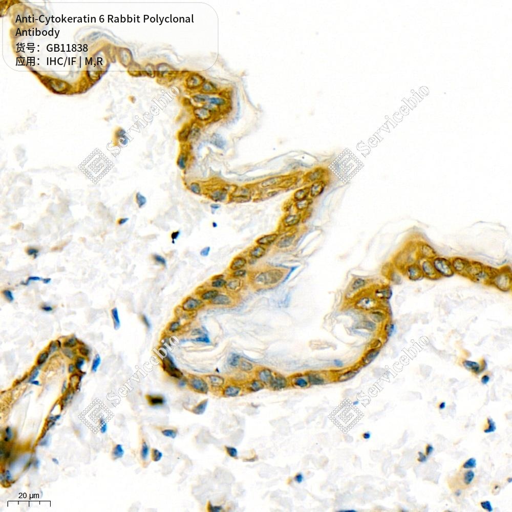 Антитела первичные, поликлональные кролика к Cytokeratin 6 крысы, мыши, 50 мкл