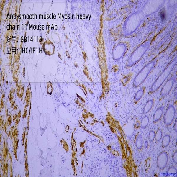 Антитела первичные, моноклональные, smooth muscle Myosin heavy chain 11, 50 мкл