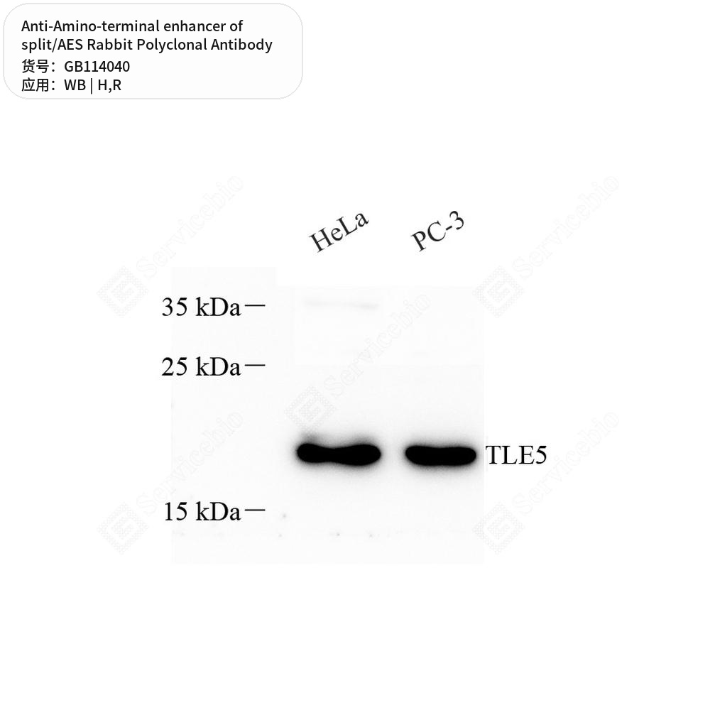 Антитела первичные, поликл. кролика к Amino-terminal enhancer of split/AES крысы, человека, 50 мкл