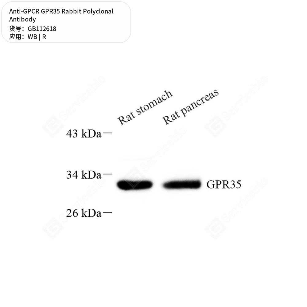 Антитела первичные, поликлональные кролика к GPCR GPR35 крысы, 100 мкл