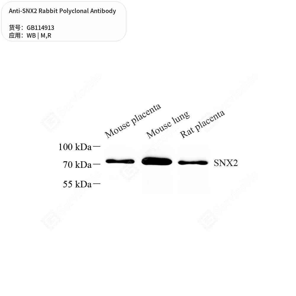 Антитела первичные, поликлональные кролика к SNX2 крысы, мыши, 100 мкл