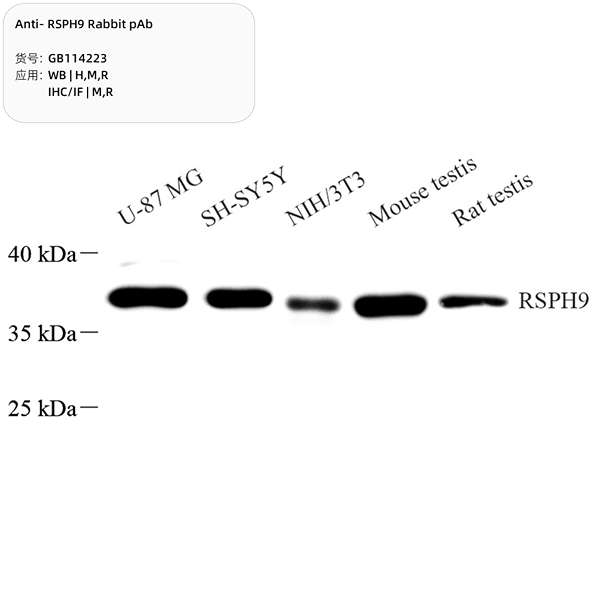 Антитела первичные, поликлональные, RSPH9, 100 мкл