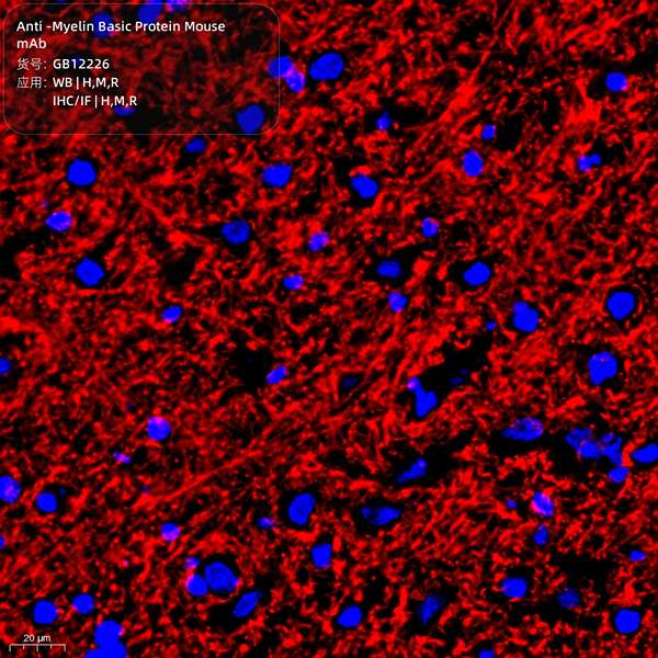 Антитела первичные, моноклональные, Myelin Basic Protein, 100 мкл